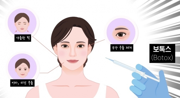 보톡스 주사 효능. 사진=와인피부과/굿모닝충청 김수미 기자