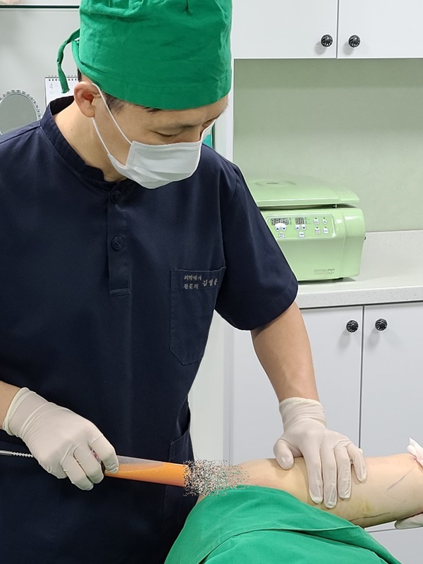 팔뚝 지방추출주사 시술. 사진=청주미앤모성형외과/굿모닝충청 김수미 기자