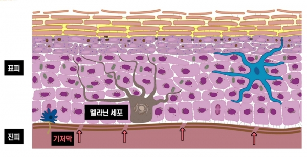 기저막 위로 올라온 멜라닌색소. 사진=피알남/굿모닝충청 김수미 기자