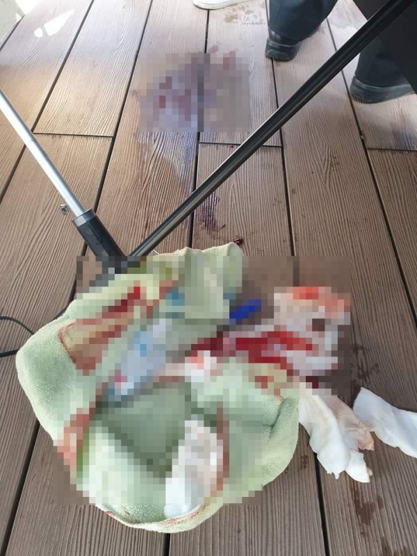 더불어민주당 정청래 최고위원이 공개한 이재명 대표 피습 현장 사진