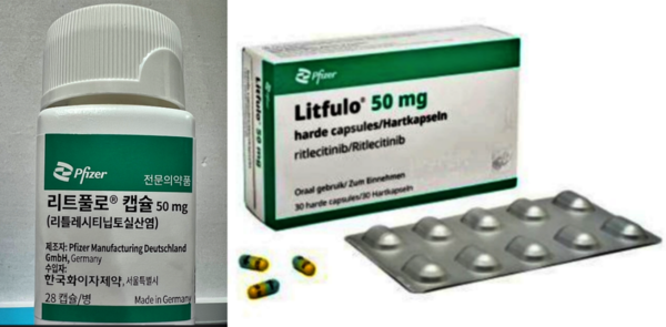 중증 원형탈모치료 신약 '리트풀로' 캡슐. (사진=청주 미앤모 탈모 클리닉 제공/굿모닝충청 김태린 기자)